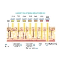 五大光子嫩膚技術(shù)（IPL、DPL、OPT、APT、BBL）及濾光片區(qū)別